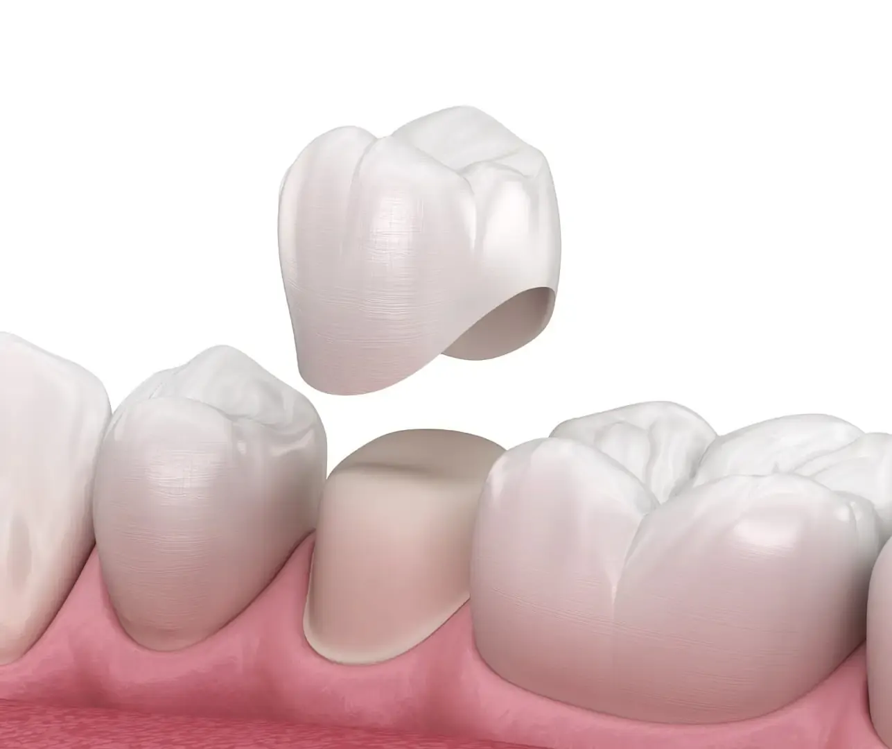 Cosmetic dentistry