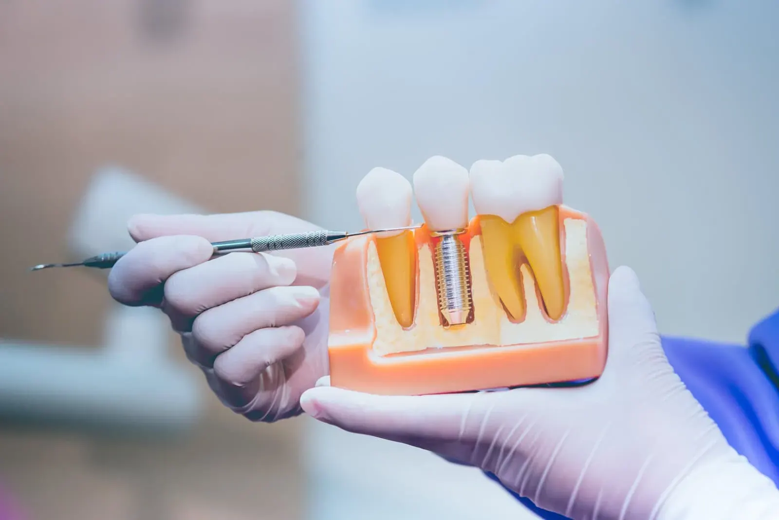Clark Dental team helping a patient understand care costs